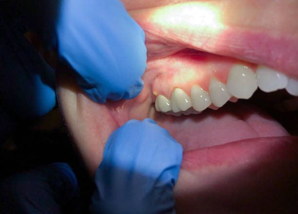 Faxon, PA Emergency Dentist Pros